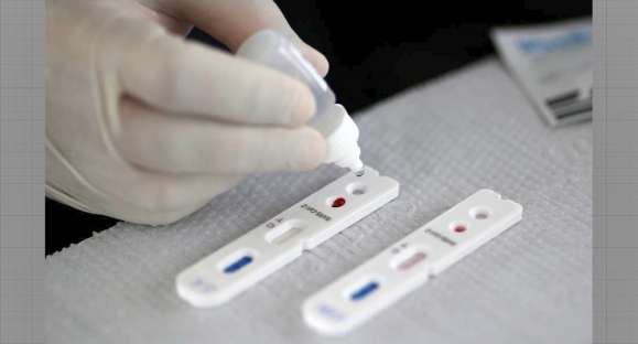 Anvisa aprova testes rápidos de COVID-19 em farmácias