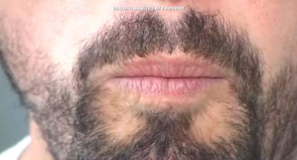 Meu amigo tem mau hálito. O que eu faço?