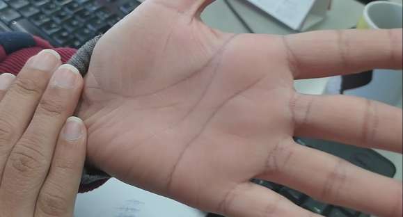 Saiba como hidratar as mãos em tempos de pandemia