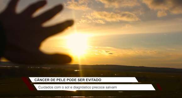 Saiba quais os cuidados necessários com a pele para evitar o câncer